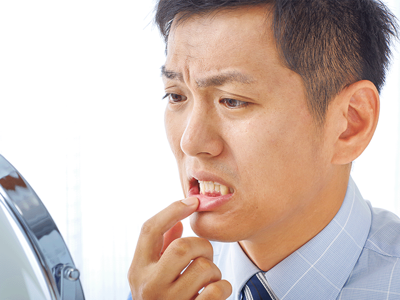 歯ぐきが気になる男性