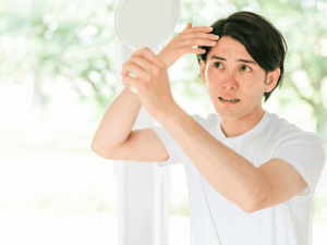 薄毛が気になる男性