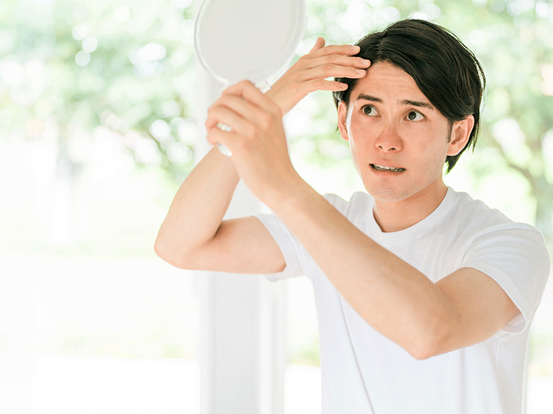 薄毛が気になる男性