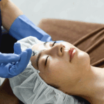 ボトックス注射