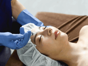 ボトックス注射