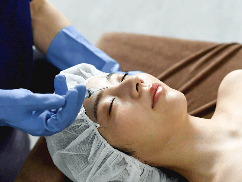 ボトックス注射